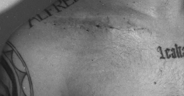 Arrascaeta exibe cicatriz da cirurgia e corre contra o tempo para disputar a Copa